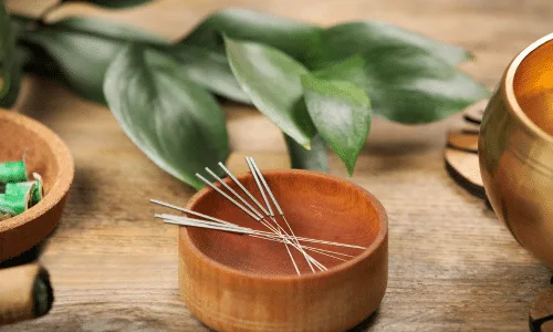 acupuncture